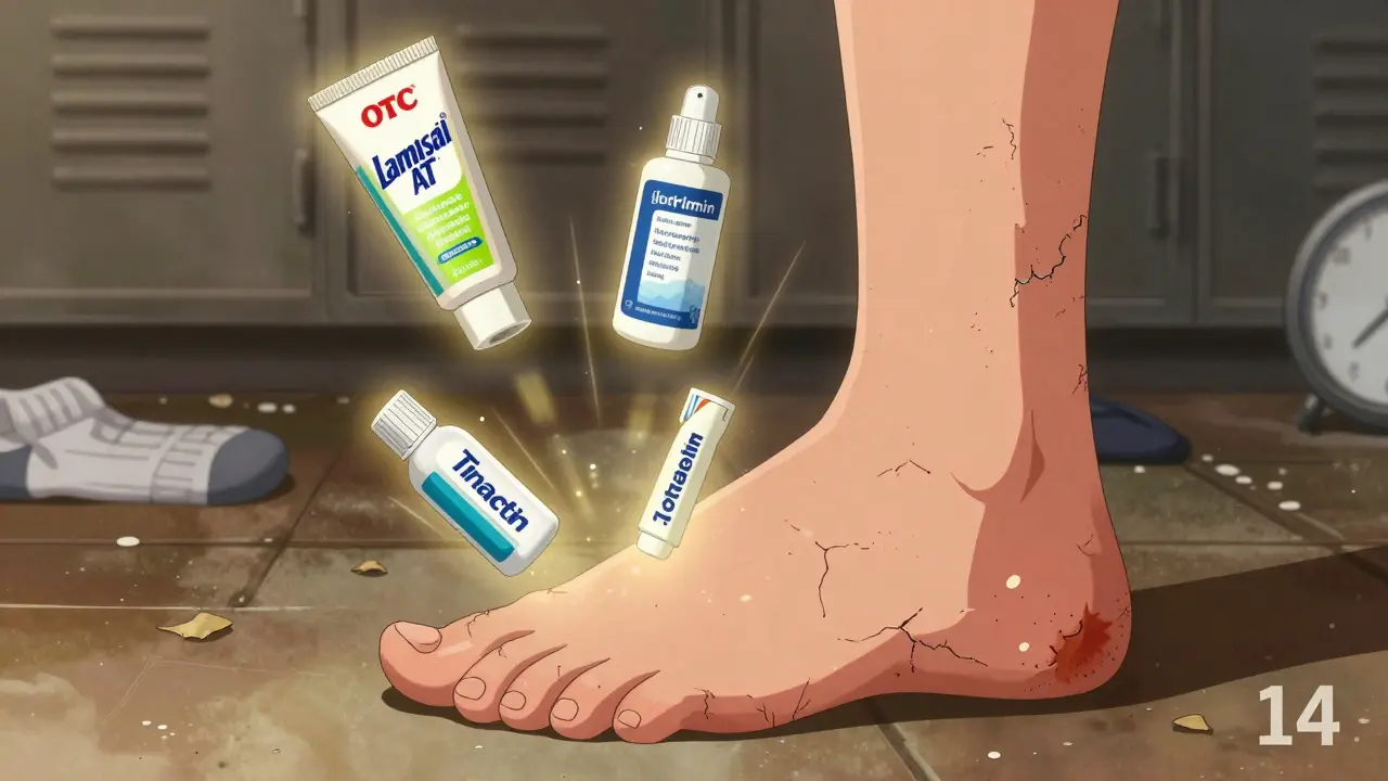 OTC Athlete’s Foot Treatments: Safe and Effective Use Guide
